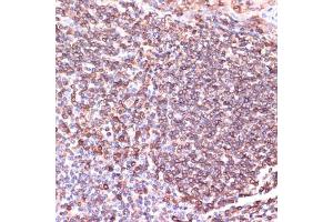 Immunohistochemistry of paraffin-embedded human tonsil using TPD52 antibody  at dilution of 1:100 (40x lens). (TPD52 抗体  (AA 1-184))