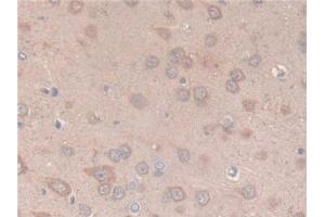 Detection of CS in Rat Brain Tissue using Polyclonal Antibody to Citrate Synthase (CS) (CS 抗体  (AA 56-312))