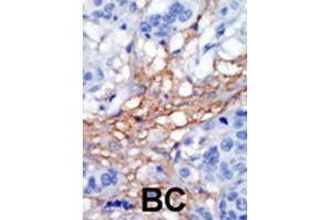 Immunohistochemistry (IHC) image for anti-Phosphatidylinositol-4-Phosphate 5-Kinase, Type I, gamma (PIP5K1C) antibody (ABIN3003648) (PIP5K1C 抗体)