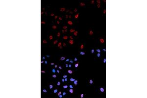 Immunofluorescence analysis of U2OS cells using Phospho-MYC-S62 antibody (ABIN5969927). (c-MYC 抗体  (pSer62))