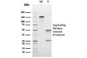 SDS-PAGE Analysis Purified BCL-6 Mouse Recombinant Monoclonal Antibody (rBCL6/1718). (Recombinant BCL6 抗体  (AA 256-389))