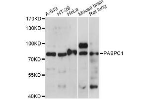 Western blot analysis of extracts of various cell lines, using PABPC1 antibody. (PC1 抗体)