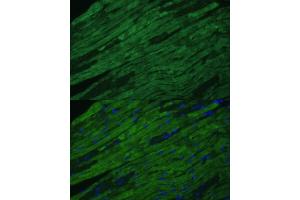 Immunofluorescence analysis of mouse heart cells using TNNI3 antibody (ABIN6132729, ABIN6149357, ABIN6149359 and ABIN6213640) at dilution of 1:100. (TNNI3 抗体  (AA 1-210))