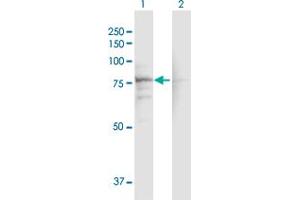 Western Blot analysis of CACNB1 expression in transfected 293T cell line by CACNB1 MaxPab polyclonal antibody. (CACNB1 抗体  (AA 1-598))