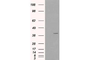 Western Blotting (WB) image for anti-Vacuolar Protein Sorting-Associated Protein 26A (VPS26A) antibody (ABIN5906188) (VPS26A 抗体)