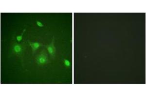 Immunofluorescence analysis of HepG2 cells, using HDAC6 (Ab-22) Antibody. (HDAC6 抗体  (AA 7-56))