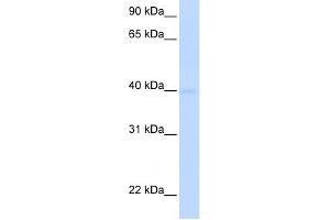 SLC25A36 antibody used at 1 ug/ml to detect target protein. (SLC25A36 抗体  (N-Term))