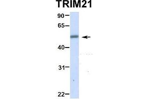 Hum. (TRIM21 抗体  (N-Term))