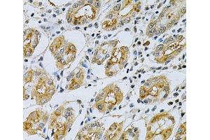 Immunohistochemistry of paraffin-embedded Human stomach using SERPINB5 Polyclonal Antibody at dilution of 1:200 (40x lens). (SERPINB5 抗体)