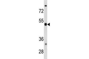 CXCR5 antibody western blot analysis in K562 lysate. (CXCR5 抗体  (AA 1-30))