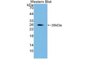 Western blot analysis of the recombinant protein. (Apolipoprotein F 抗体  (AA 111-314))