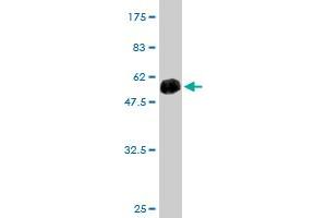 Western Blot detection against Immunogen (49. (TRAPPC4 抗体  (AA 1-219))