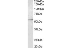 Western Blotting (WB) image for anti-Tubulin, beta 3 (TUBB3) (Internal Region) antibody (ABIN1449438) (TUBB3 抗体  (Internal Region))