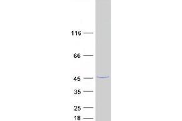 C3orf37 Protein (Transcript Variant 1) (Myc-DYKDDDDK Tag)