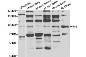 Western blot analysis of extracts of various cell lines, using IWS1 antibody (ABIN4904098) at 1:1000 dilution. (IWS1 抗体)