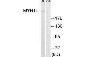 Western blot analysis of extracts from 293 cells, using MYH14 antibody. (Myosin 抗体  (Internal Region))