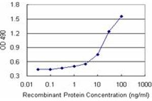 Sandwich ELISA detection sensitivity ranging from 0. (PDLIM1 (人) Matched Antibody Pair)