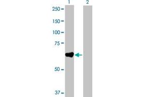 Western Blot analysis of GAD2 expression in transfected 293T cell line by GAD2 MaxPab polyclonal antibody. (GAD65 抗体  (AA 1-585))