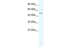 TPTE antibody used at 1. (TPTE 抗体  (C-Term))