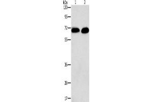 Western Blotting (WB) image for anti-Protein Kinase C, alpha (PKCa) antibody (ABIN2434183) (PKC alpha 抗体)