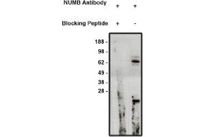 Image no. 1 for anti-Numb Homolog (NUMB) antibody (ABIN4620367) (NUMB 抗体)