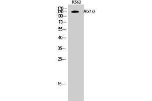 Western Blotting (WB) image for anti-Abelson Murine Leukemia Viral Oncogene Homolog 1/2 (ABL1/ABL2) (Lys5) antibody (ABIN3173634) (ABL1/2 抗体  (Lys5))