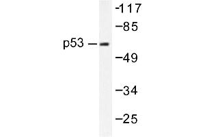 Image no. 1 for anti-Tumor Protein P53 (TP53) antibody (ABIN271768) (p53 抗体)