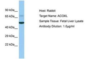 Image no. 1 for anti-Acyl-CoA Oxidase-Like (ACOXL) (AA 263-312) antibody (ABIN6750230) (ACOXL 抗体  (AA 263-312))