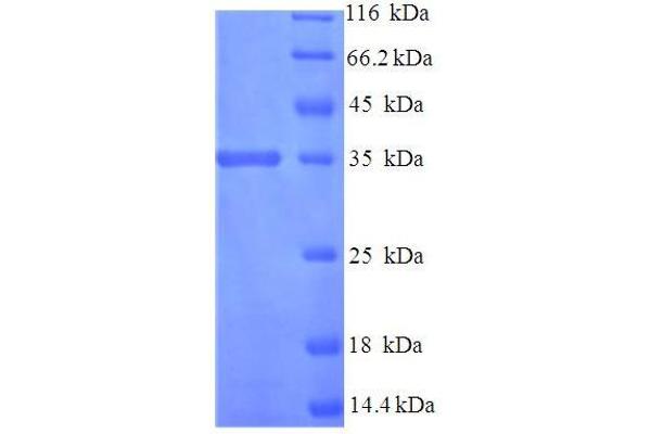 TMX3 Protein (AA 25-195, Isoform 2) (His-SUMO Tag)