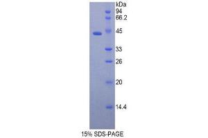 SDS-PAGE (SDS) image for Cathelicidin Antimicrobial Peptide (CAMP) (AA 30-175) protein (His tag,GST tag) (ABIN2122567) (Cathelicidin Protein (AA 30-175) (His tag,GST tag))