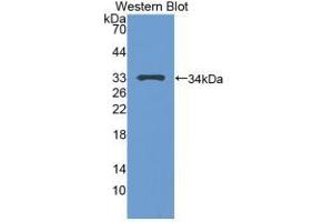 Detection of Recombinant TP53, Human using Polyclonal Antibody to Tumor Protein p53 (P53) (p53 抗体  (AA 108-370))
