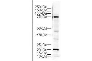 Western blot using  Affinity Purified anti-LIM Kinase antibody shows detection of a 73 kDa band corresponding to LIM kinase in lysates from mouse brain. (LIM Domain Kinase 1 抗体  (AA 630-647))