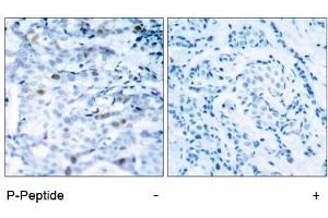 Image no. 1 for anti-Cyclin-Dependent Kinase 1 (CDK1) (pThr161) antibody (ABIN196846) (CDK1 抗体  (pThr161))