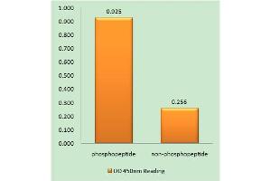 Immunohistochemistry analysis of paraffin-embedded human brain tissue using ITCH (Phospho-Tyr420) antibody. (ITCH 抗体  (pTyr420))