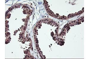 Immunohistochemistry (IHC) image for anti-Nonhomologous End-Joining Factor 1 (NHEJ1) antibody (ABIN1499733) (NHEJ1 抗体)