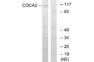 Western blot analysis of extracts from 293 cells, using CDCA2 antibody. (CDCA2 抗体)