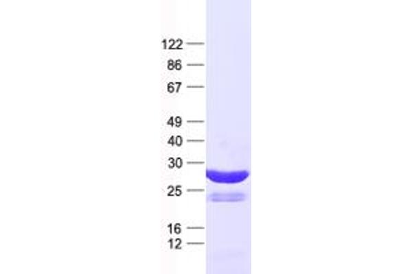 OSR1 Protein (His tag)