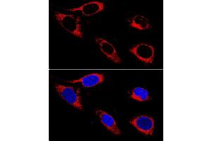Confocal immunofluorescence analysis of U-2OS cells using P4HB antibody (ABIN3021093, ABIN3021094, ABIN3021095 and ABIN1513299) at dilution of 1:400. (P4HB 抗体  (AA 329-508))