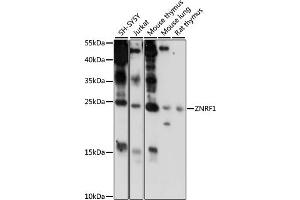 Western blot analysis of extracts of various cell lines, using ZNRF1 antibody (ABIN7271433) at 1000 dilution. (ZNRF1 抗体  (AA 1-170))