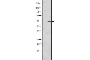 Western blot analysis of CNNM1 expression in Human tonsil tissue lysate,The lane on the left is treated with the antigen-specific peptide. (Cyclin M1 抗体)