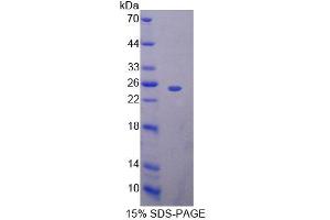 SDS-PAGE analysis of Mouse BAG5 Protein. (BAG5 蛋白)