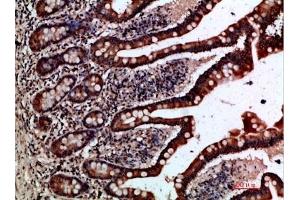 Immunohistochemical analysis of paraffin-embedded human-small-intestine, antibody was diluted at 1:200. (GREM2 抗体  (AA 71-120))