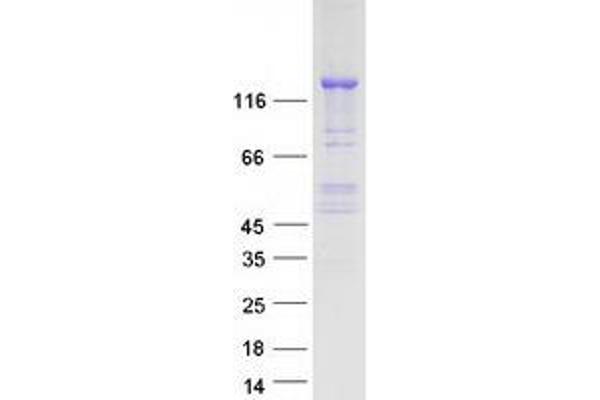 Codanin 1 (CDNA1) protein (Myc-DYKDDDDK Tag)