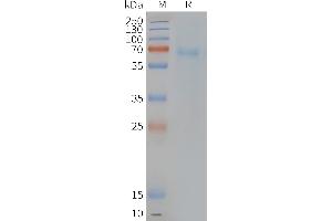 Human PT-Nanodisc, Flag Tag on SDS-PAGE (Prostaglandin D2 Receptor 2 (PTGDR2) 蛋白)
