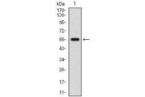 Western blot analysis using NFE2L2 mAb against human NFE2L2 (AA: 356-589) recombinant protein. (NRF2 抗体  (AA 356-589))