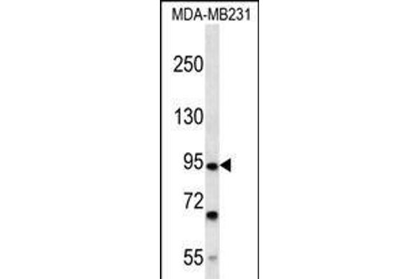 FSD2 抗体  (N-Term)