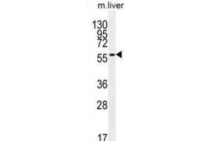 Western Blotting (WB) image for anti-7-Dehydrocholesterol Reductase (DHCR7) antibody (ABIN2996203) (DHCR7 抗体)