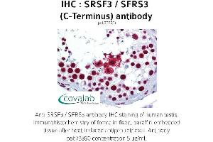 Image no. 1 for anti-serine/arginine-Rich Splicing Factor 3 (SRSF3) antibody (ABIN1739659) (SRSF3 抗体)