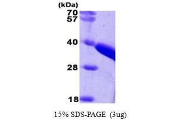 TST Protein (AA 1-297)