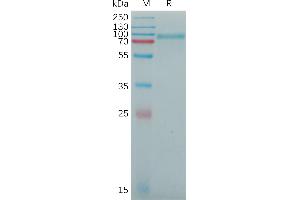 SEMA4B Protein (AA 44-716) (His tag)